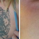 Illustration for article titled The Ultimate Guide to Laser Tattoo Removal